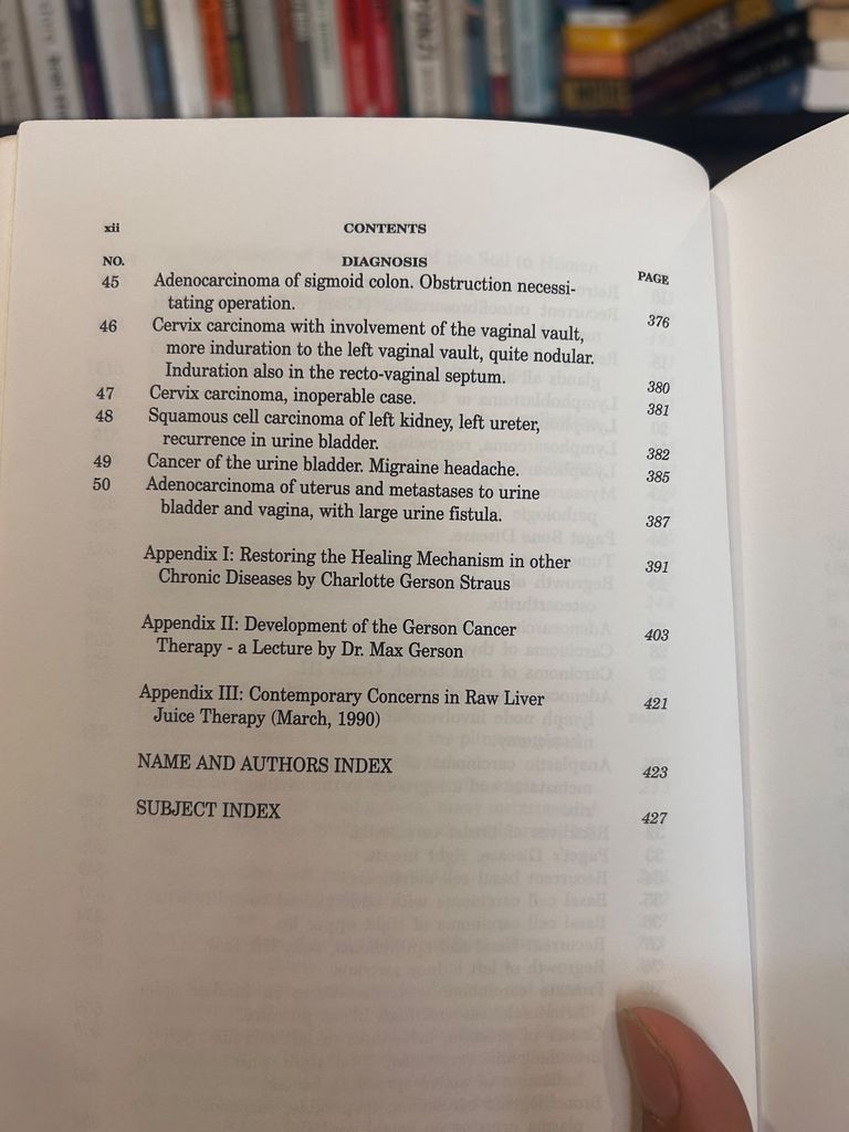 A Cancer Therapy : A Summary Of Thirty Years Of Clinical Experimentation - Max Gerson, M.D 