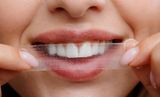 SNOW Dissolving Teeth Whitening Strips 4-in-1 – Miếng dán trắng răng tự tan 56 miếng (42 Extra Strength + 14 Purple)