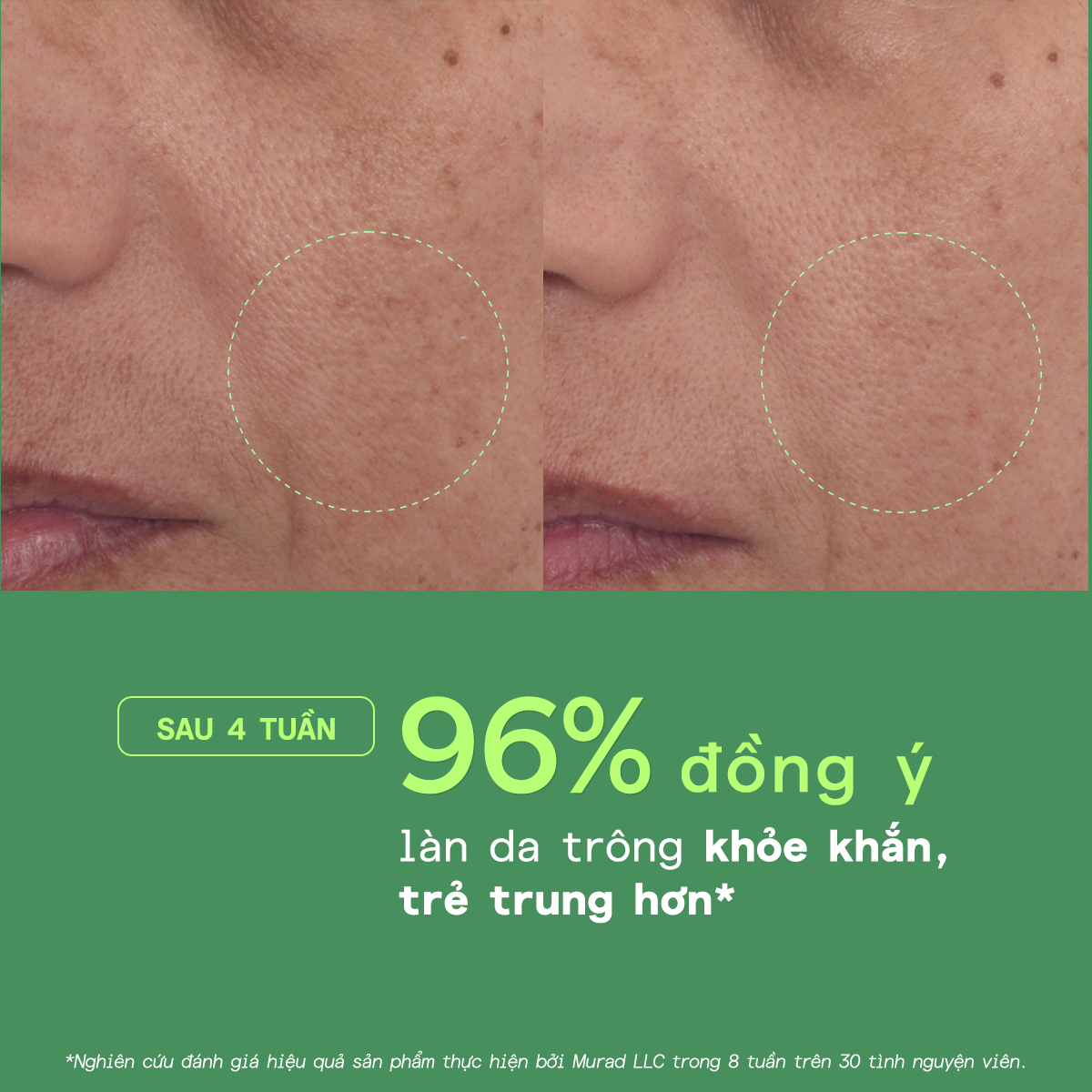 Serum Retinol Giúp Da Căng Bóng - Murad Retinol Youth Renewal Serum 30ml