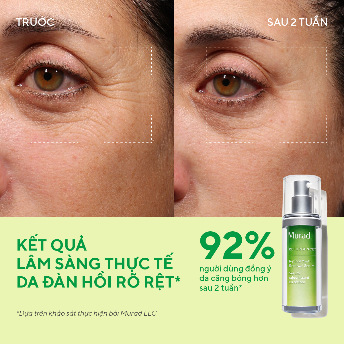 RESURGENCE - Tinh chất Retinol giúp da mịn màng và làm mờ nếp nhăn Murad Retinol Youth Renewal Serum 30ml