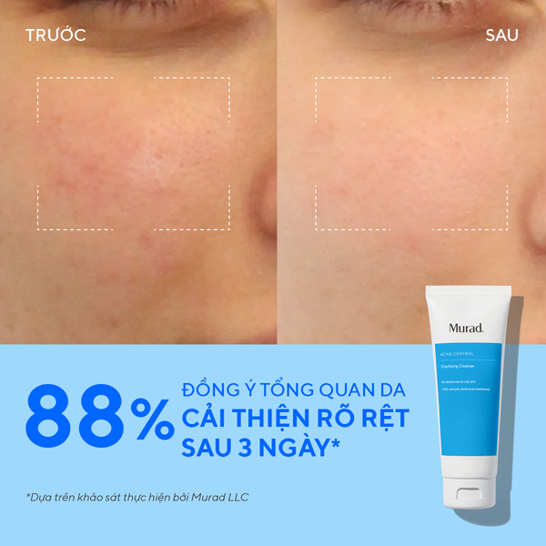 Sữa Rửa Mặt Làm Sạch Ngừa Mụn - Murad Clarifying Cleanser 148ml
