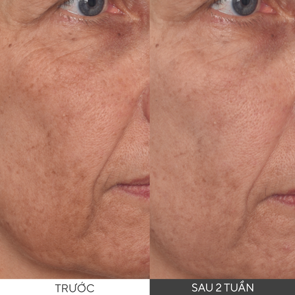 [SALE 30%] Tinh chất hỗ trợ sáng da, làm đều màu da Murad Vita-C Glycolic Serum 30ml