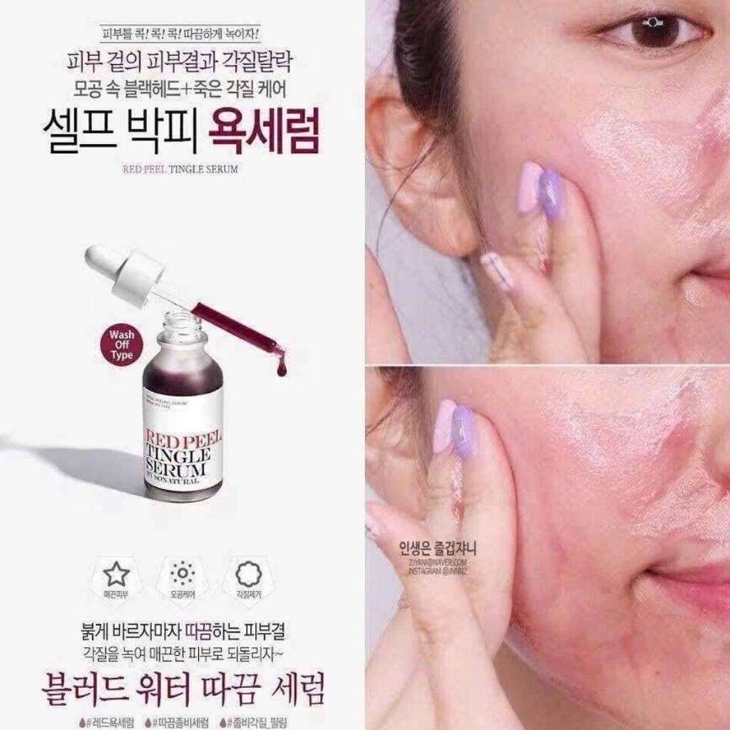  Serum Red Peel Tingle So dưỡng da mềm min BKCOKR-9106 
