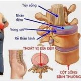  Thuốc bổ khớp Kwangdong Hàn Quốc BKHEKR-9196 