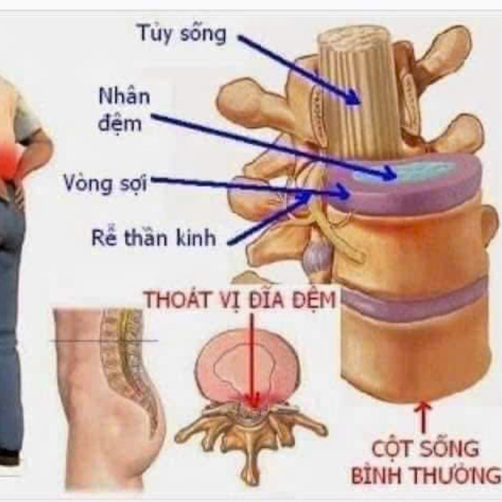  Thuốc bổ khớp Kwangdong Hàn Quốc BKHEKR-9196 