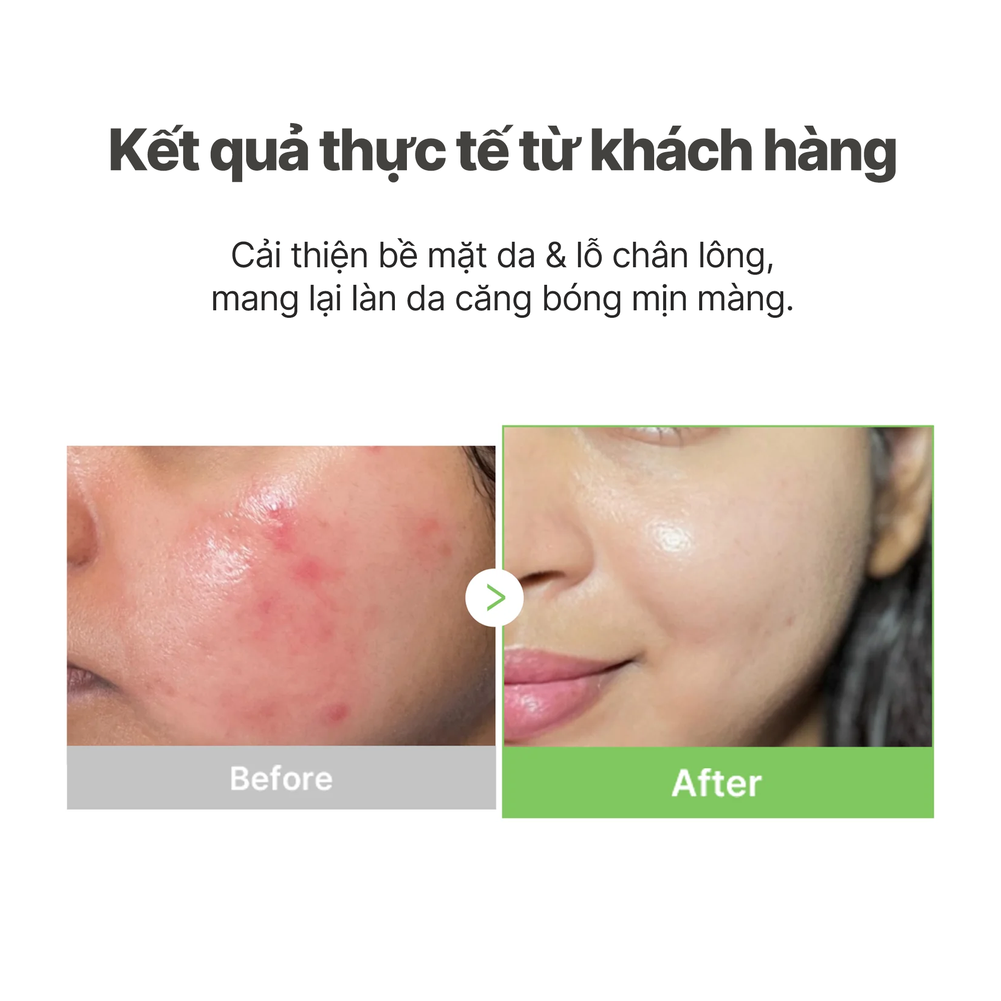  Toner Pad Exosome Cica Calming 100 miếng / 150ml 