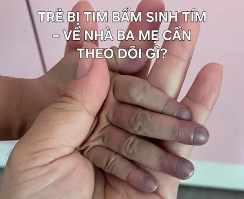 TRẺ BỊ TIM BẨM SINH TÍM – VỀ NHÀ BA MẸ CẦN THEO DÕI GÌ?