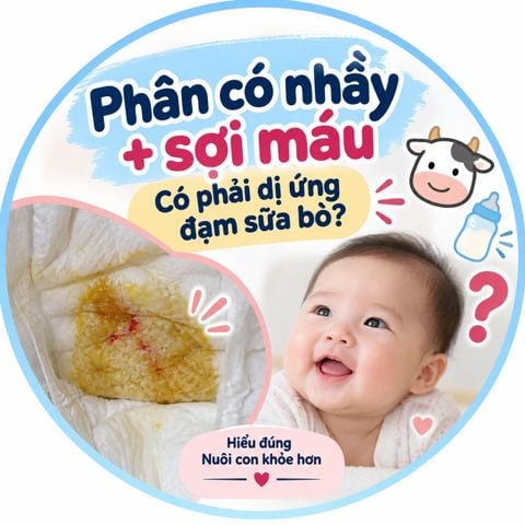 VIÊM ĐẠI TRỰC TRÀNG DỊ ỨNG DO PROTEIN THỨC ĂN (FPIAP) Ở TRẺ NHỎ