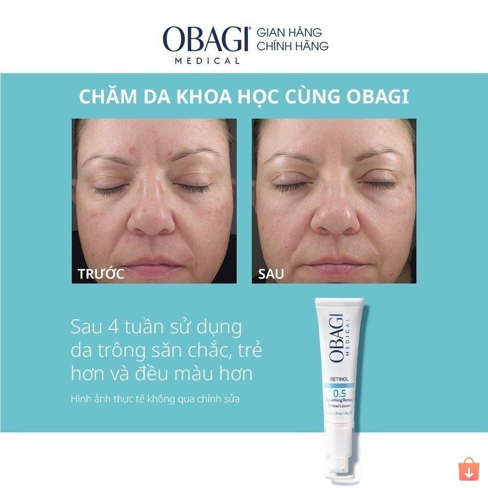 Kem Chống Lão Hóa & Tái Tạo Da Obagi 360 Retinol 0.5 28g