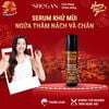  Serum khử mùi ngừa thâm nách và chân SHeGAN (9ml) 