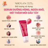  (TẶNG SET 2 KẸP LÁ CỜ) Combo 2 Tuýp Serum Dưỡng Hồng, Ngừa Khô, Mờ Thâm Môi Dâu Tây 6g - Mềm Môi, Hồng  Môi Tự Nhiên, Căng Mọng, Không Chứa Chì, Dưỡng Môi, Son Dưỡng 