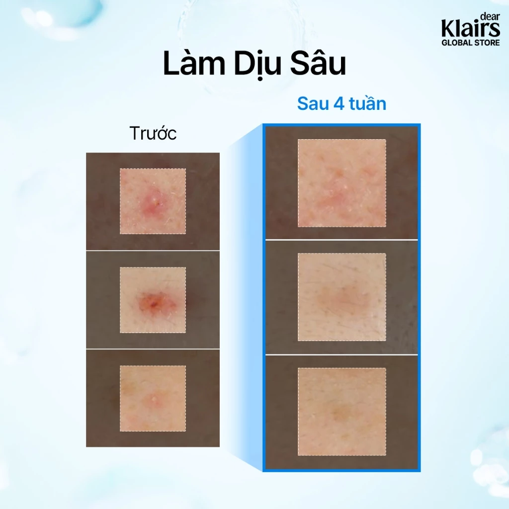 Dear Klairs Tinh chất EGF Blue AC Calming Serum 50g 7