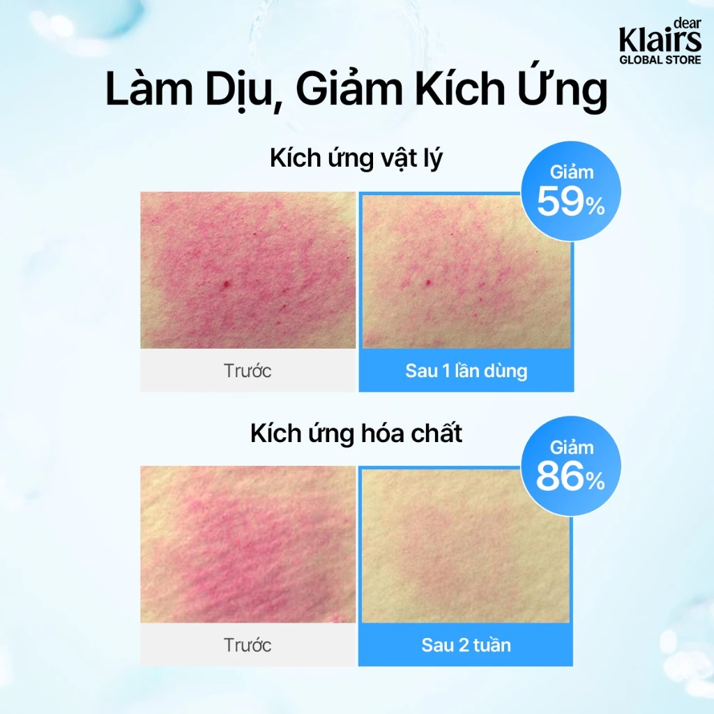 Dear Klairs Tinh chất EGF Blue AC Calming Serum 50g 3