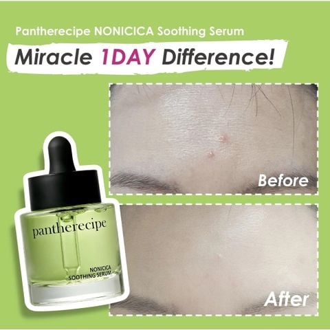 Pestlo Tinh chất Pantherecipe Nonicica Soothing Serum 30ml