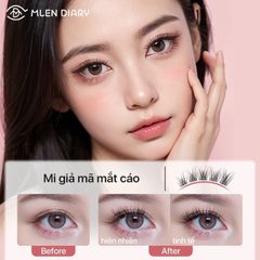 Mlen Diary Mi cáo