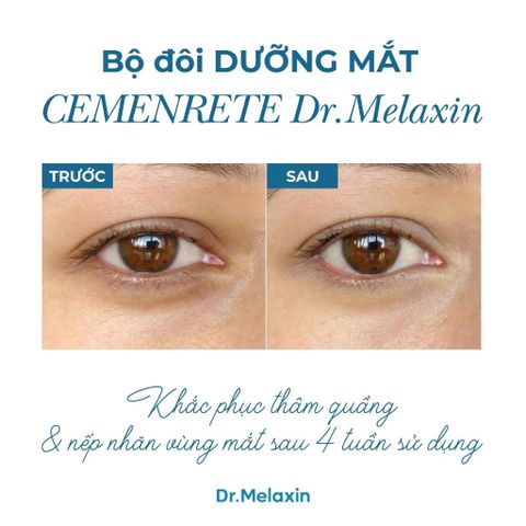Dr. Melaxin Kem dưỡng mắt - đa năng Cemenrete Calcium Volume Cream - Ex Volume Firming 50ml