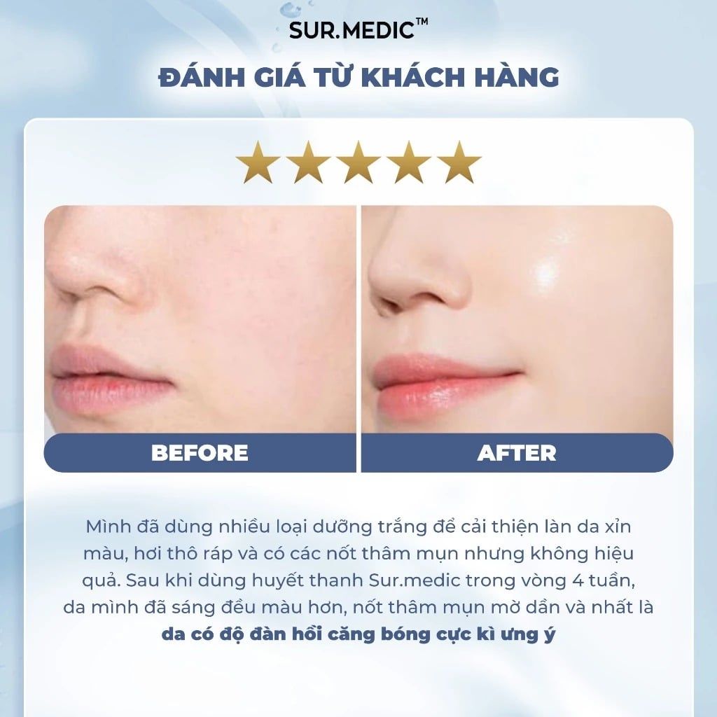 can glutathione remove pigmentation There are several use cases where a course of IV glutathione can help  support pigmentation treatments, different clinics have different protocols  based on what worked for them. Even within RENDER,
