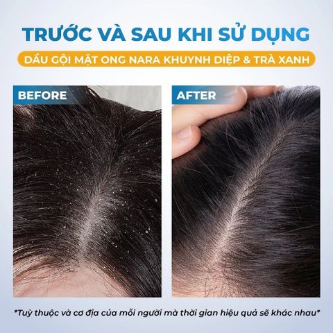 Nara Combo Gội Xả Mật ong Khuynh diệp trà xanh 500mlx2