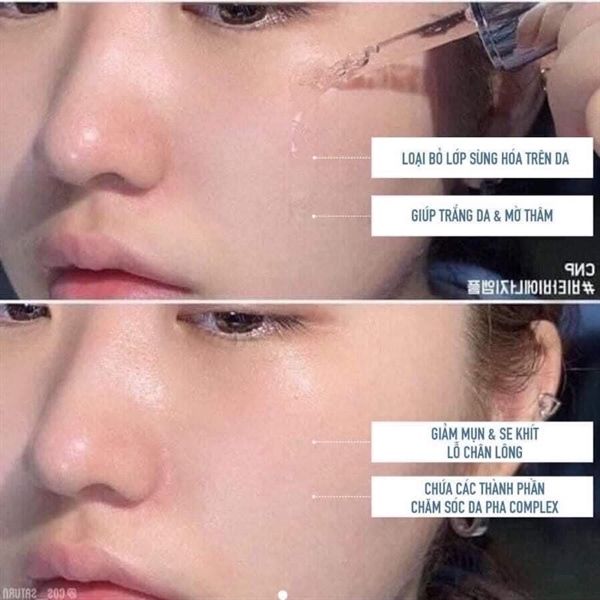 Vỉ tinh chất peel da CNP Rx Skin Rejuvenating Intensive Peel 2ml