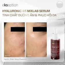 Tinh chất Ekseption Hyaluronic B5 mixlab serum cấp ẩm phục hồi 75ml