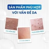  Combo trọn bộ chăm da dầu mụn khoa học Acne Full Combo 