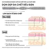  Tẩy tế bào chết Exfoliation Cream 40g 