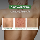  Xịt 99ok99 và mờ thâm cơ thể Exfoliating Body Spray 100ml 