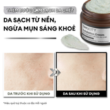 Tẩy tế bào chết Exfoliation Cream 40g 