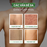  Combo 2 bước 99ok99 & mờ thâm toàn thân: 99ok hiện đang mở tẩy tế bào chết 250ml & Xịt 99ok99 mờ thâm 100ml 