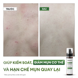  Xịt 99ok99 và mờ thâm cơ thể Exfoliating Body Spray 100ml 