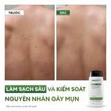  99ok hiện đang mở tẩy tế bào chết & 99ok99 lưng Exfoliating Body Wash 250ml 