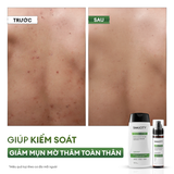  Combo 2 bước 99ok99 & mờ thâm toàn thân: 99ok hiện đang mở tẩy tế bào chết 250ml & Xịt 99ok99 mờ thâm 100ml 