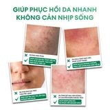  Kem dưỡng Derma Pro Moisturizing Cream 50g 