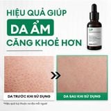  Combo chăm sóc phục hồi da Recovery Trio 