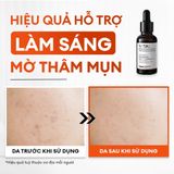  Combo mờ thâm sáng da tiêu chuẩn Brightening Trio 