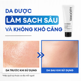  Sữa rửa mặt sạch dầu nhờn & ngừa mụn 100G 