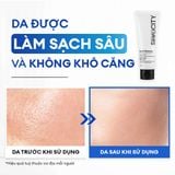 Sữa rửa mặt sạch dầu nhờn & ngừa mụn 100G 