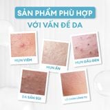  Serum Calm giảm mụn & làm dịu da 30ml 