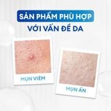  Combo giảm mụn sưng viêm Acne Duo 