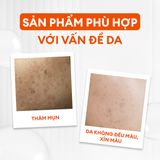  Combo mờ thâm sáng da tiêu chuẩn Brightening Trio 