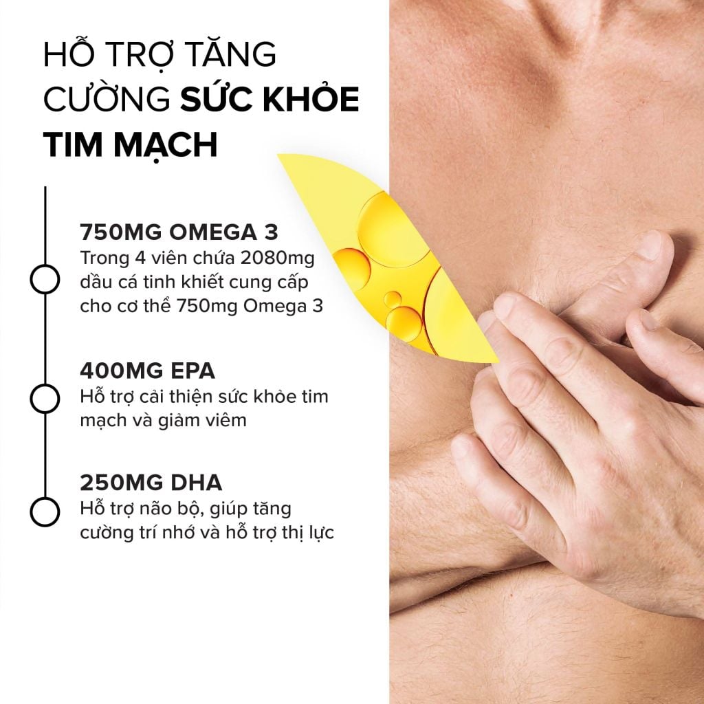 Dầu cá Omega 3 Pháp Arkopharma hỗ trợ tim mạch, não bộ, thị lực, bổ sung DHA EPA-TPBVSK ARKOGELULES OMEGA 3 (60v)