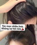  Tinh chất nuôi dưỡng tóc LOREAL ORDER 