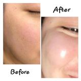  Obagi KINETIN 0922517 SA 