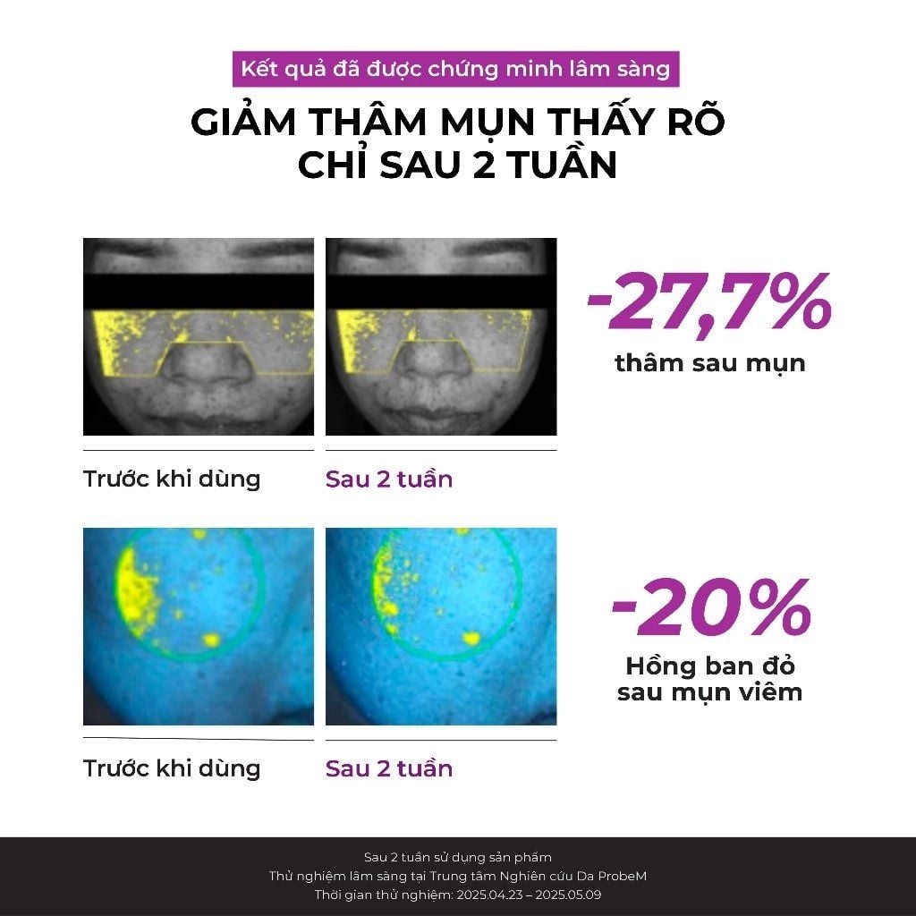 Tinh Chất Jumiso Niacinamide 20 Serum Dưỡng Sáng Mờ Thâm 40ml