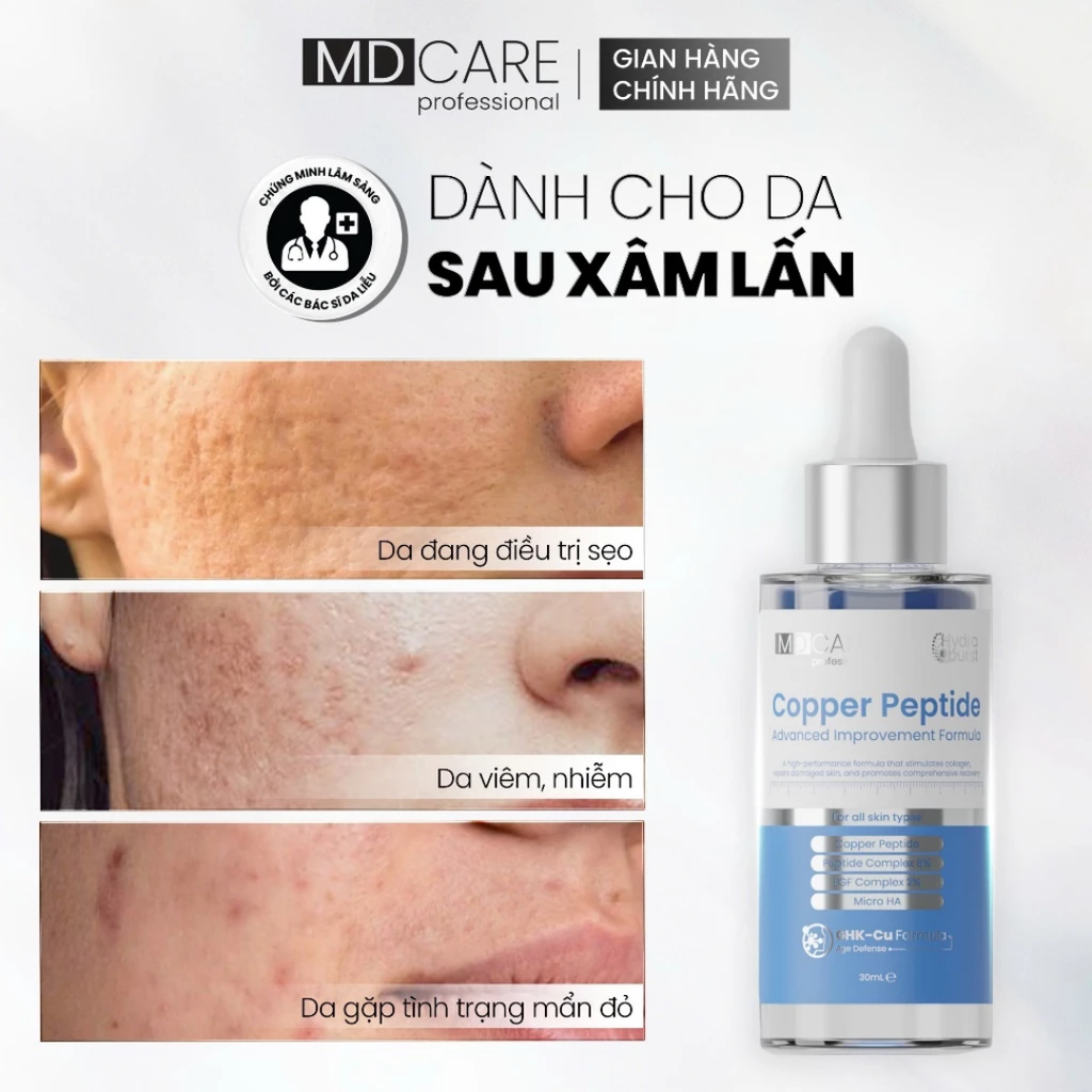 Tinh Chất MD Care Copper Peptide Serum Chống Lão Hóa, Tăng Sinh Collagen 30ml