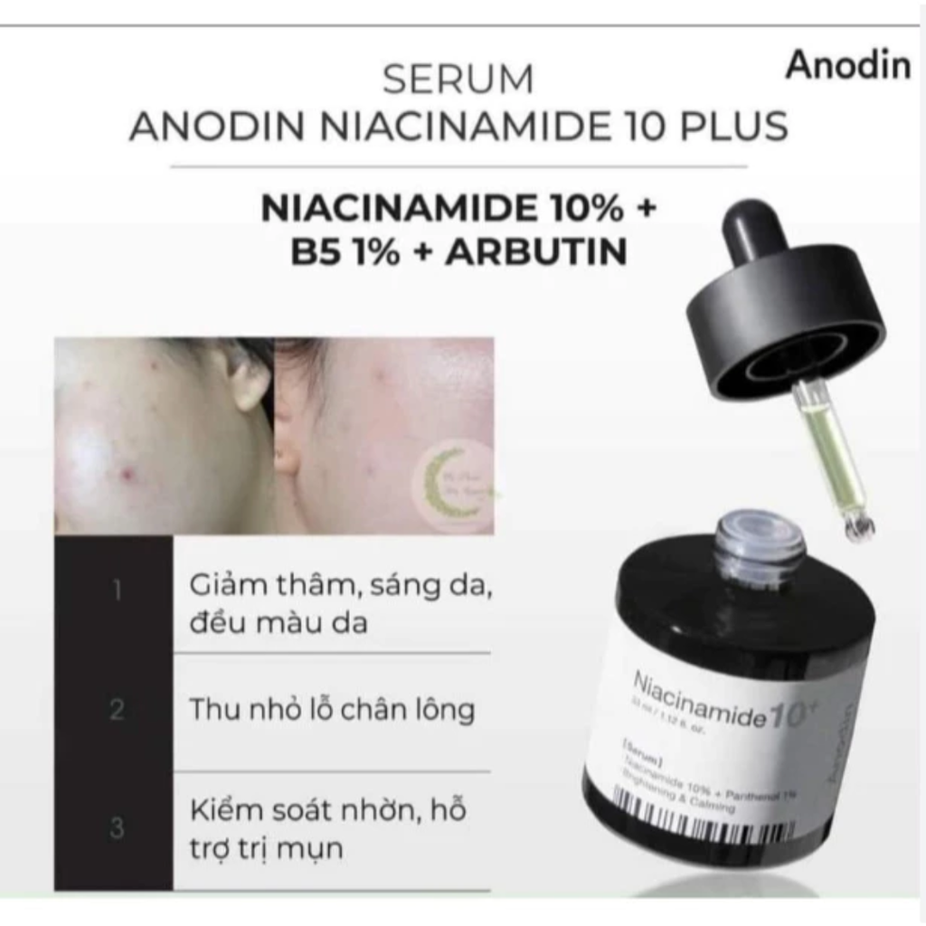 Tinh Chất Anodin Niacinamide 10 Plus Serum Làm Trắng, Thu Nhỏ Lỗ Chân Lông 33ml