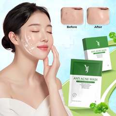 Mặt Nạ Yuejin Anti Acne Mask Giảm Mụn 25ml