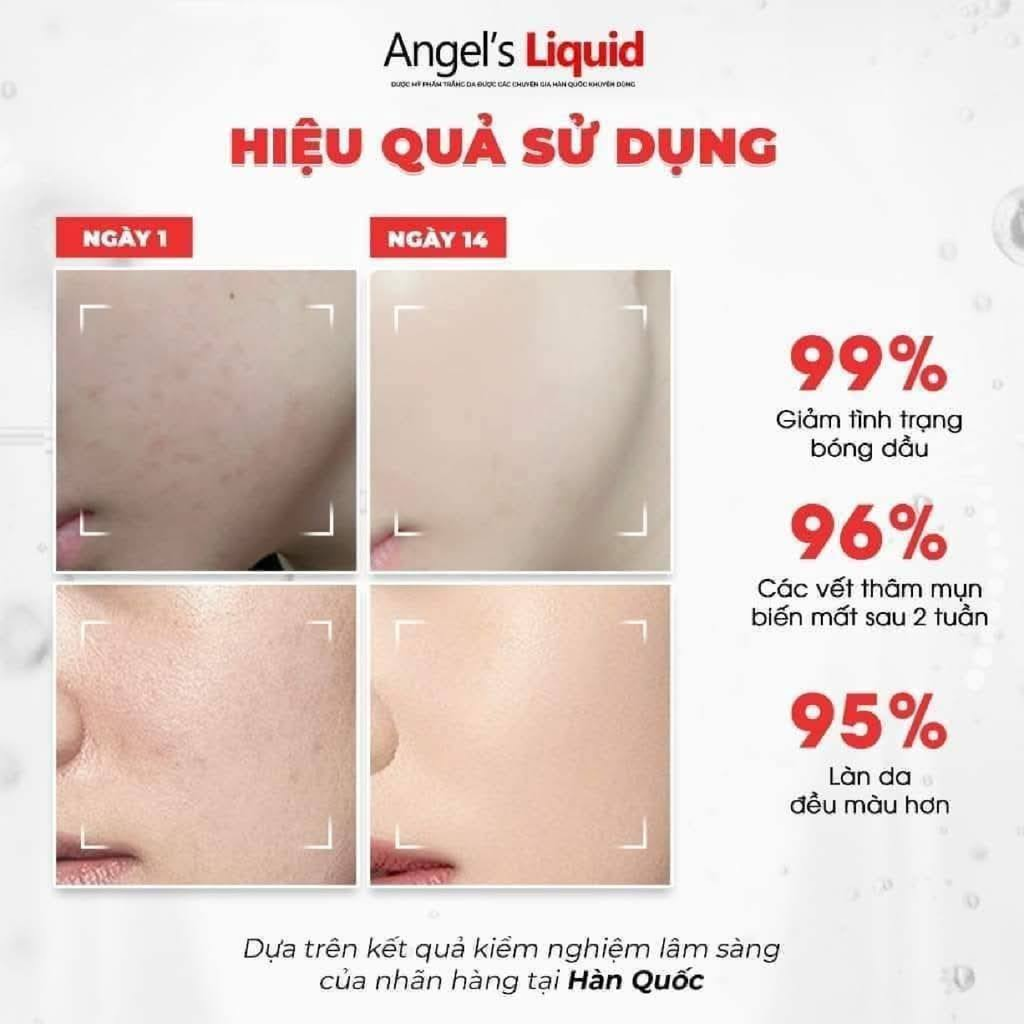 Kem Dưỡng Trắng Angel’s Liquid Glutathione Plus Niacinamide Cica Kiểm Soát Dầu, Thu Nhỏ Lỗ Chân Lông 50ml