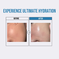 Tinh Chất Jumiso Waterfull Hyaluronic Acid Serum Dưỡng Ẩm, Căng Bóng Da 50ml