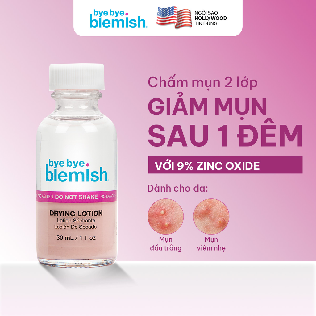 Dung Dịch Chấm Mụn Bye Bye Blemish Lotion 30ml